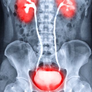  Allevia l'infiammazione